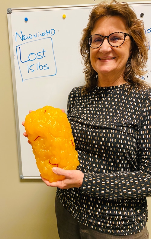 Weight Loss Success at New Viva MD Weight Loss